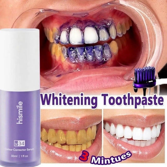 HiSmile v34 Purple Teeth Whitening Toothpaste Kit