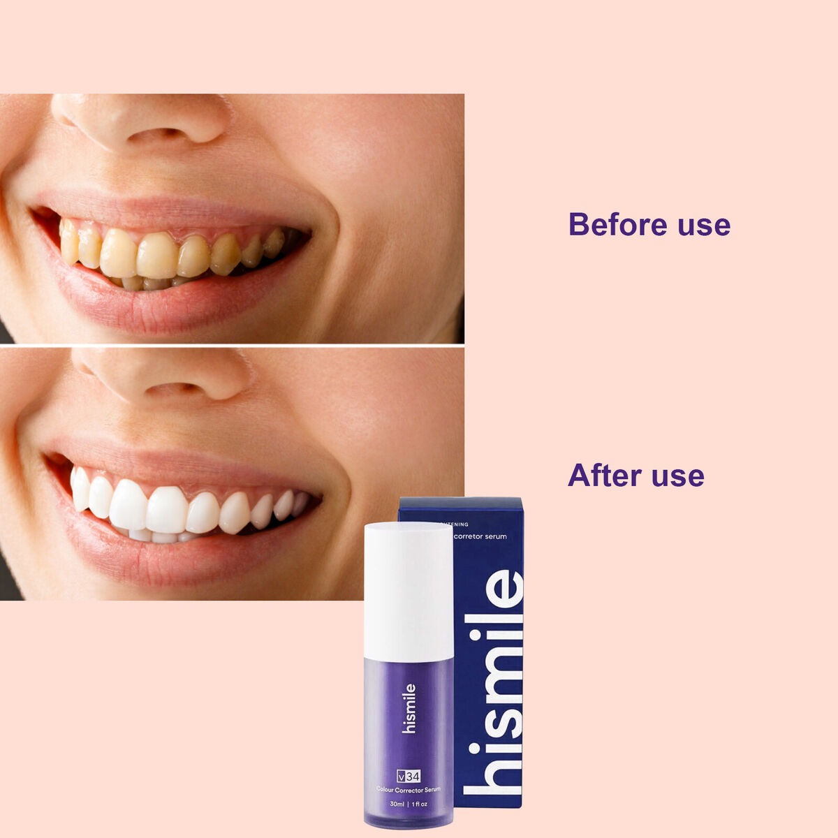 HiSmile v34 Purple Teeth Whitening Toothpaste Kit